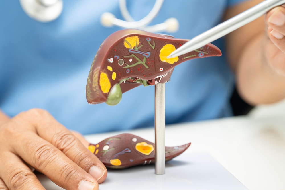 Fatty Liver