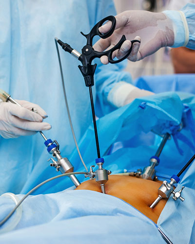 Surgical gastroenterology